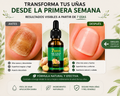 RevitaUñas™ Serum Reparador 7D | Recupera la belleza natural de tus uñas