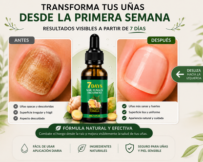 RevitaUñas™ Serum Reparador 7D | Recupera la belleza natural de tus uñas