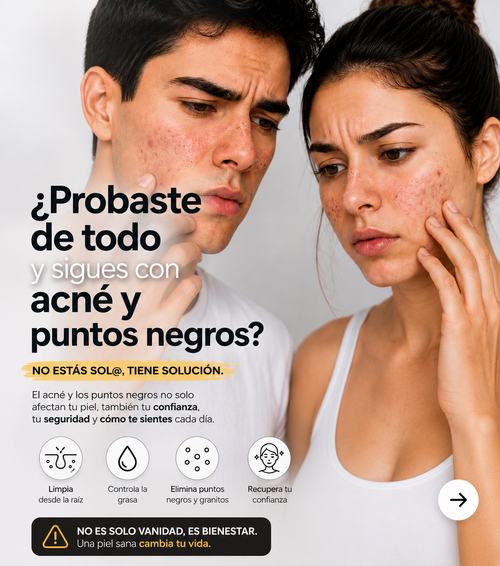MASCARILLA LANBENA™ - Fórmula potente que elimina acné y puntos negros desde la raíz