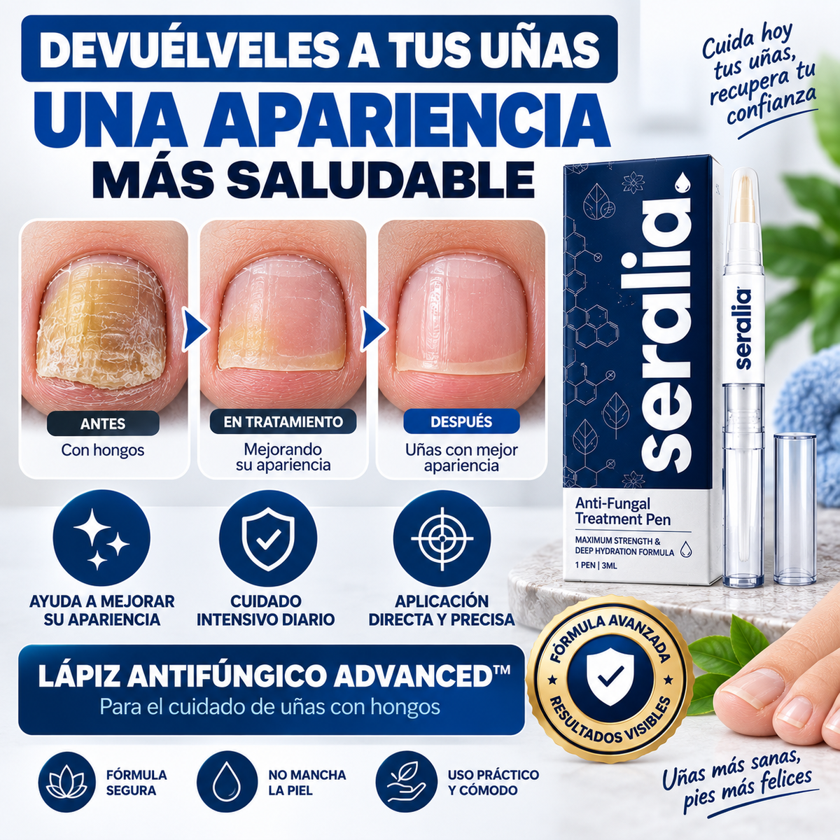 LÁPIZ ANTIFÚNGICO ADVANCED™ | PARA EL CUIDADO DE UÑAS CON HONGOS - FÓRMULA INTENSIVA