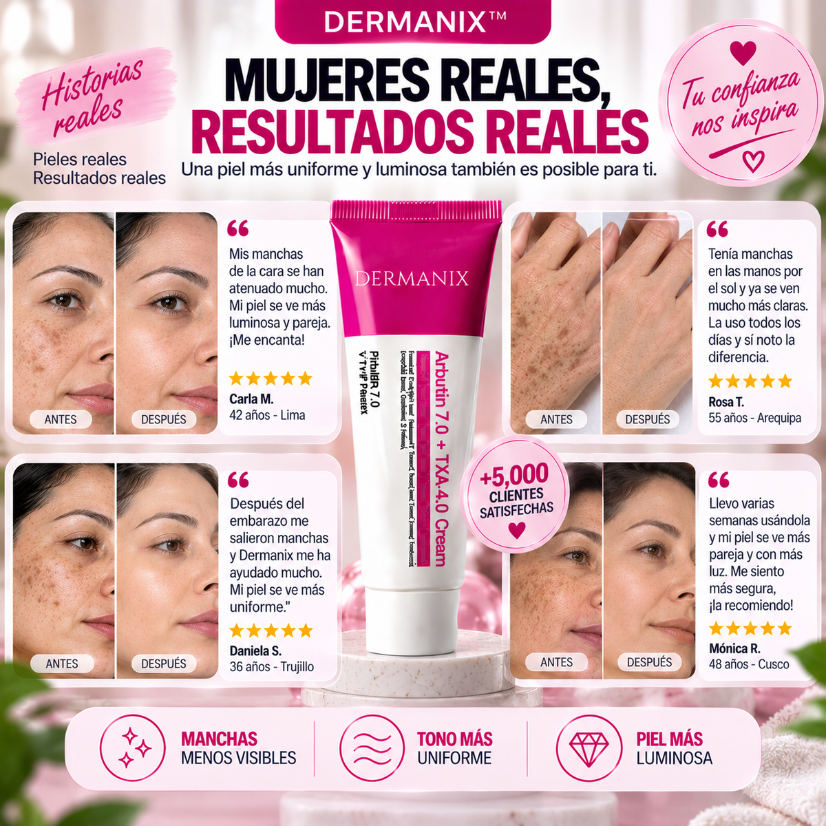 DERMANIX™ | CREMA INTENSIVA PARA EL MELASMA Y MANCHAS DE LA PIEL