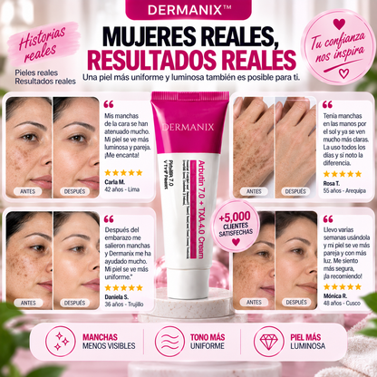 DERMANIX™ | CREMA INTENSIVA PARA EL MELASMA Y MANCHAS DE LA PIEL
